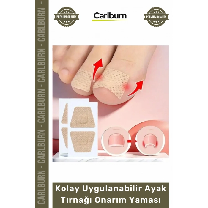 Özel Üretim Mantar Karşıtı Yenileyici Bakım Etkili Kolay Uygulanabilir Ayak Tırnağı Onarım Yaması