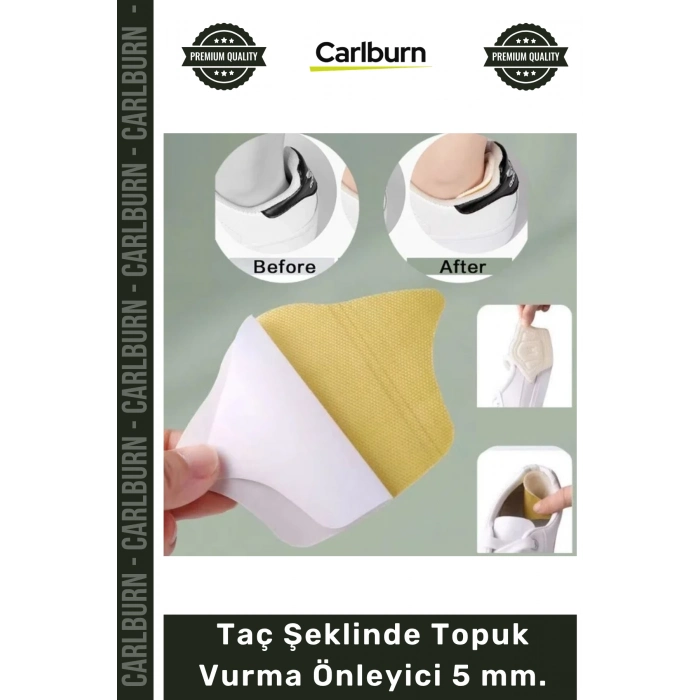 #AyakBakımı Ayakkabı Arkası Koruyucu Konfor Pedi Siyah Ten Renk Taç Şeklinde Topuk Vurma Önleyici 5mm