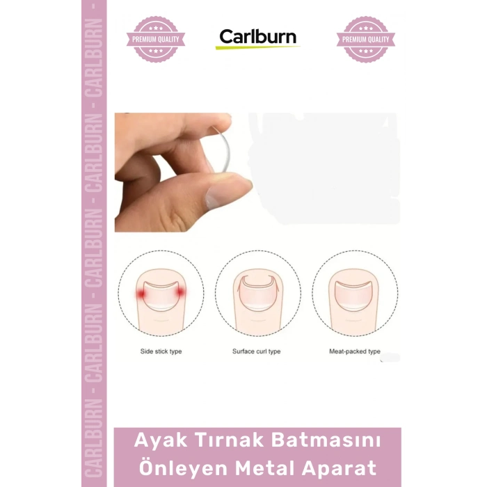 Özel Üretim Paslanmaz Çelik Ergonomik Tırnak Düzeltici Seti Ayak Tırnak Batmasını Önleyen Metal Aparat