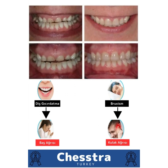 Kutulu Diş Çene Sıkma Gıcırdatma Gece Plağı Koruyucu Önleyici Dişlik Uyku Silikon Aparatı 3 Adet