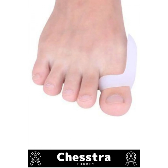 Özel Üretim Kemik Ayak Baş Parmak Bunyon Makarasız Halluks Valgus Silikon Koruyucu 1 Çift