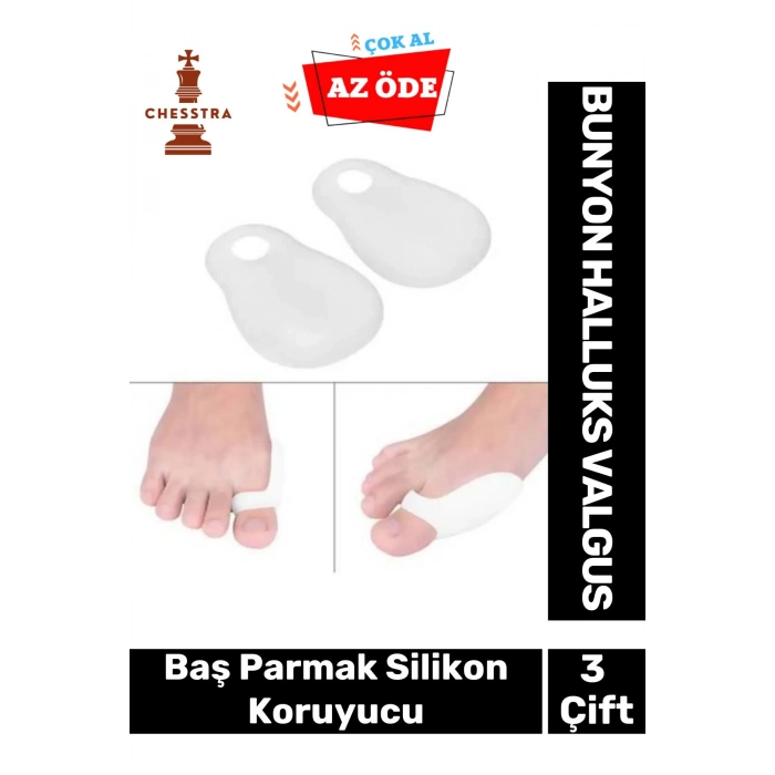 Özel Üretim Kemik Ayak Baş Parmak Bunyon Makarasız Halluks Valgus Silikon Koruyucu 3 Çift