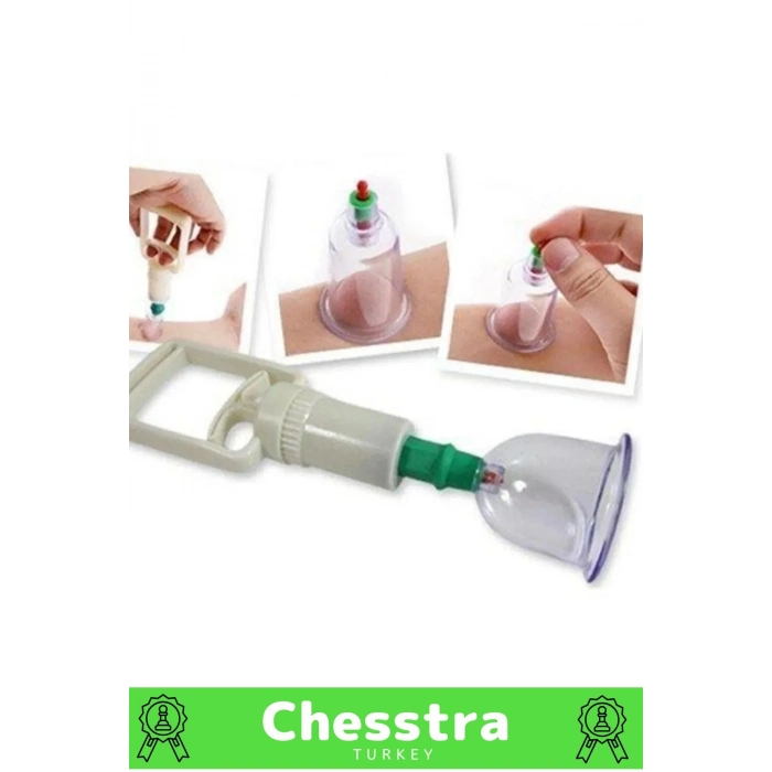 Premium Kupa Parmak Çekme Selülit Çatlak Giderici Vakumlu Masaj Aleti 36lı Kupa + Pompa Hacamat Set