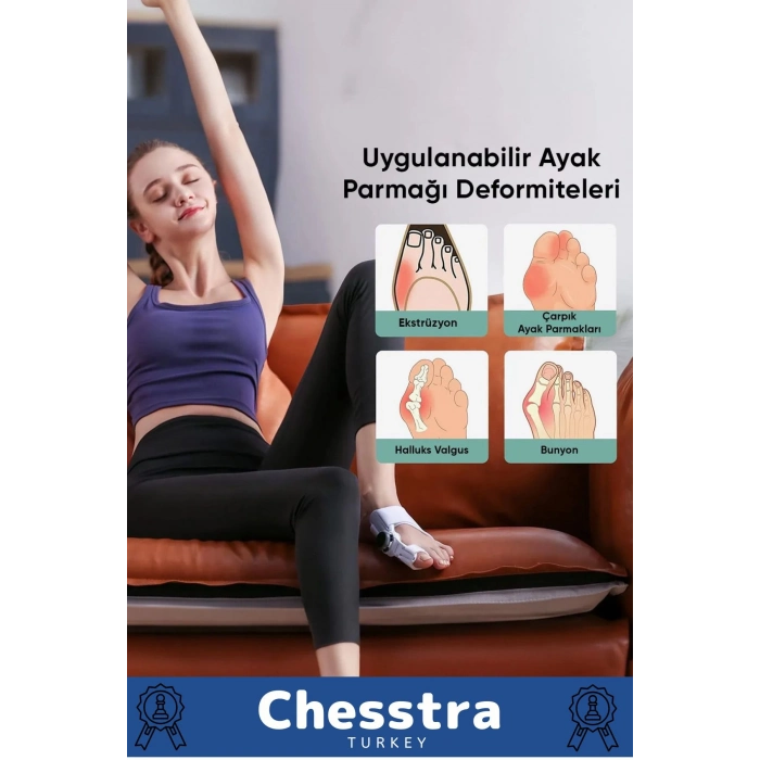 Yumuşak Yıkanabilir Bedensiz Koruma Aparat Sağ Sol Ayak Uyumlu Baş Parmak Kemik Düzeltici 4 Adet