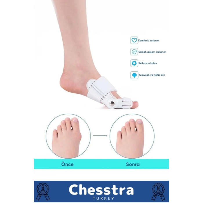 Yumuşak Yıkanabilir Bedensiz Koruma Aparat Sağ Sol Ayak Uyumlu Baş Parmak Kemik Düzeltici 6 Adet