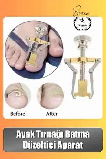 #Tırnak Ayak Tırnağı Batma Düzeltici Aparat Düzeltici Evde Kolay Pratik Batık Tırnak Bakım Aleti