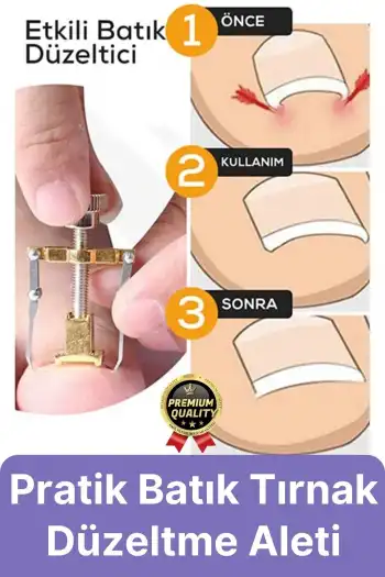 #Tırnak Kolay Bakım Orijinal Çelik Batma Ağrıyı Azaltan Düzeltme Aleti Batık Tırnak Çıkartıcı Aparat