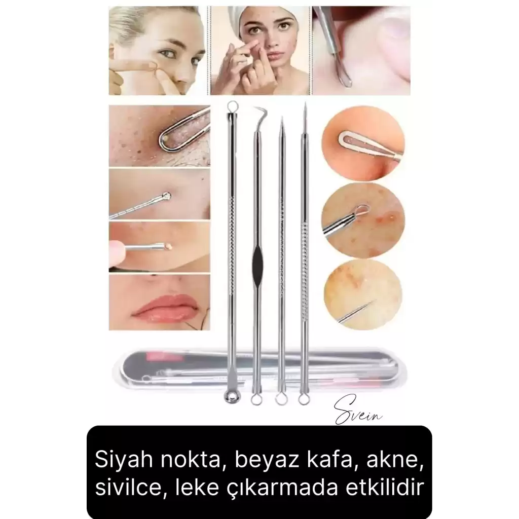 Siyah Nokta Akne Temizleyici Giderici Çıkarıcı Komedon 4lü Set Kutulu Yağ bezesi Sivilce İğnesi