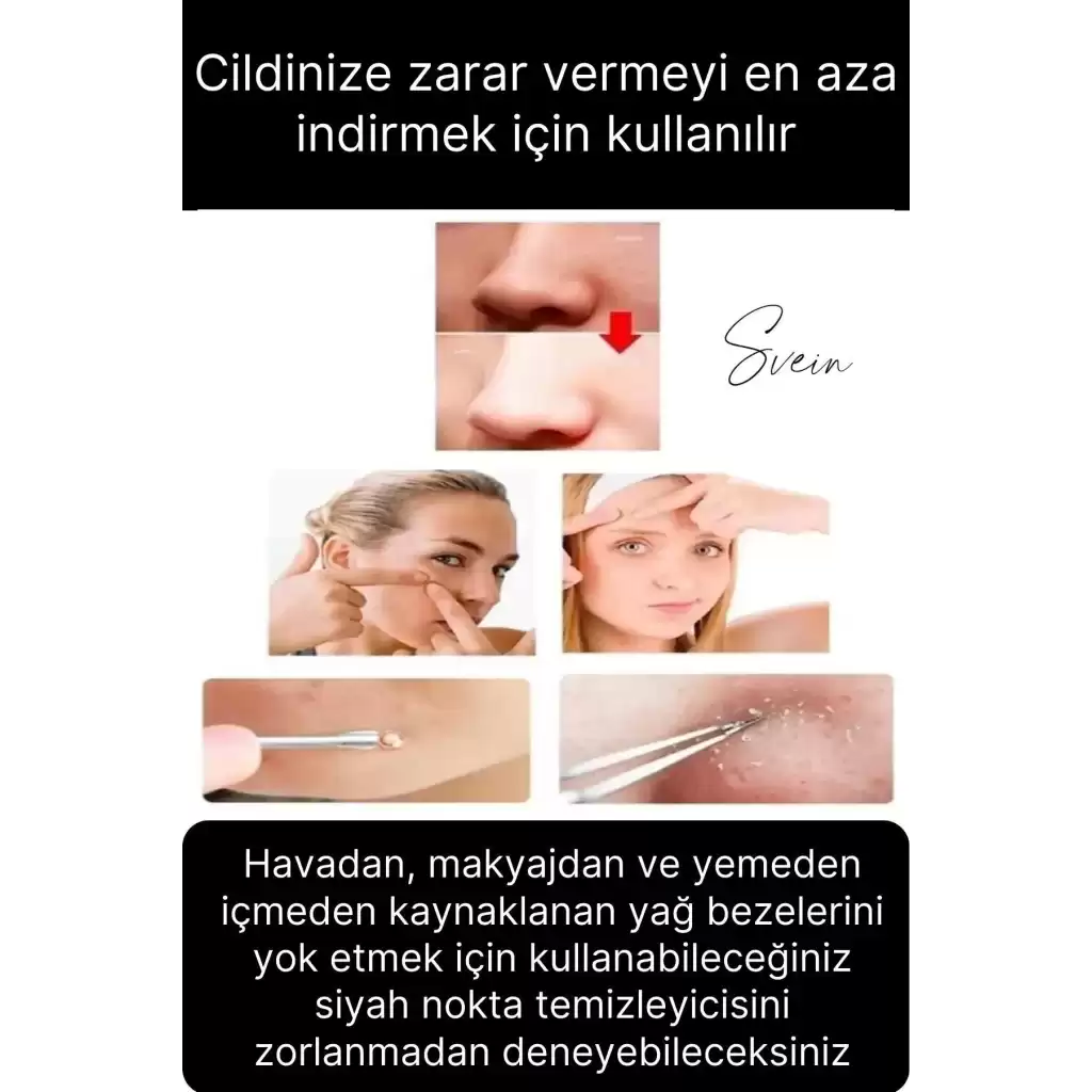 Siyah Nokta Akne Temizleyici Giderici Çıkarıcı Komedon 4lü Set Kutulu Yağ bezesi Sivilce İğnesi