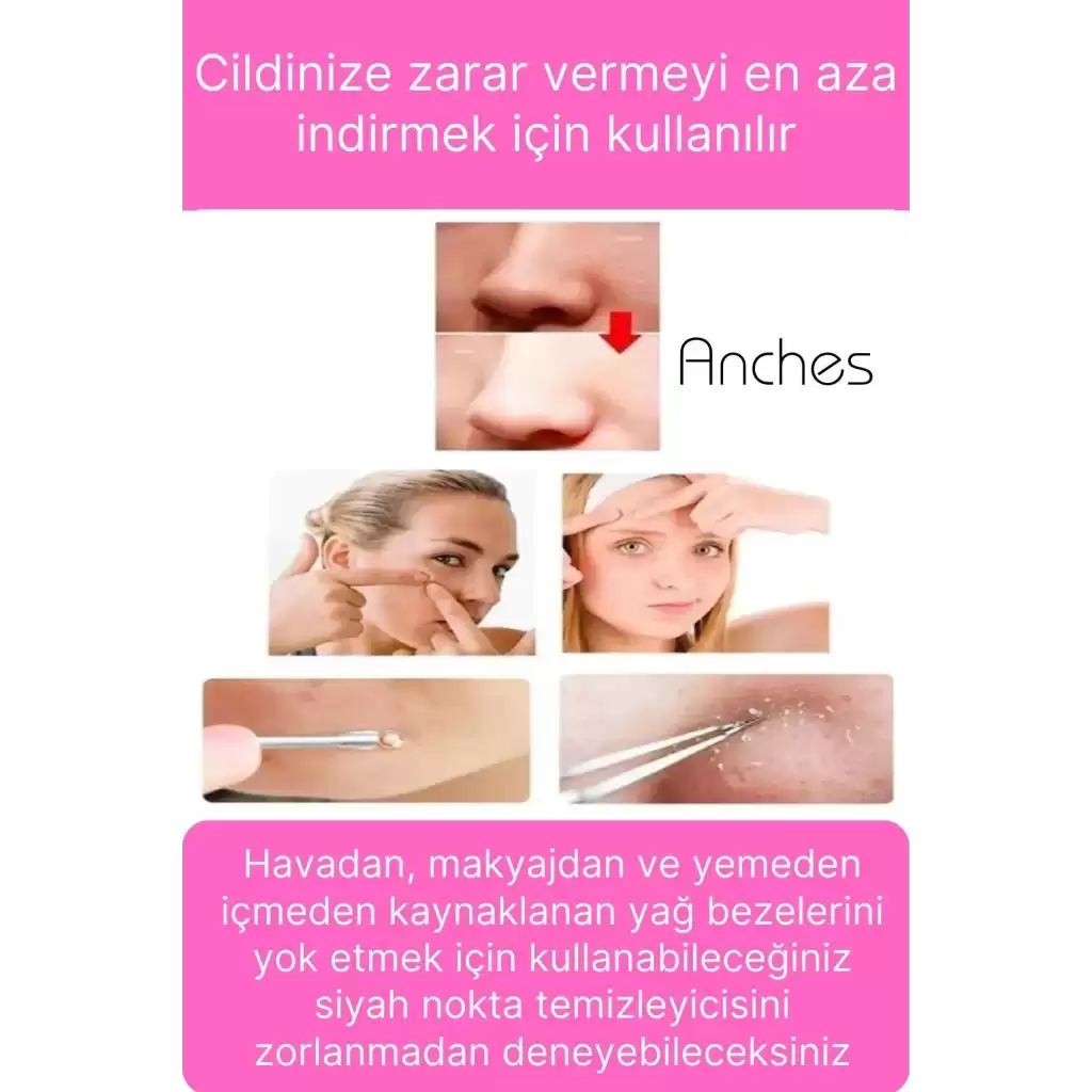 Siyah Nokta Akne Temizleyici Giderici Çıkarıcı Cilt Bakım 4lü Set Kutulu Yağ bezesi Sivilce İğnesi