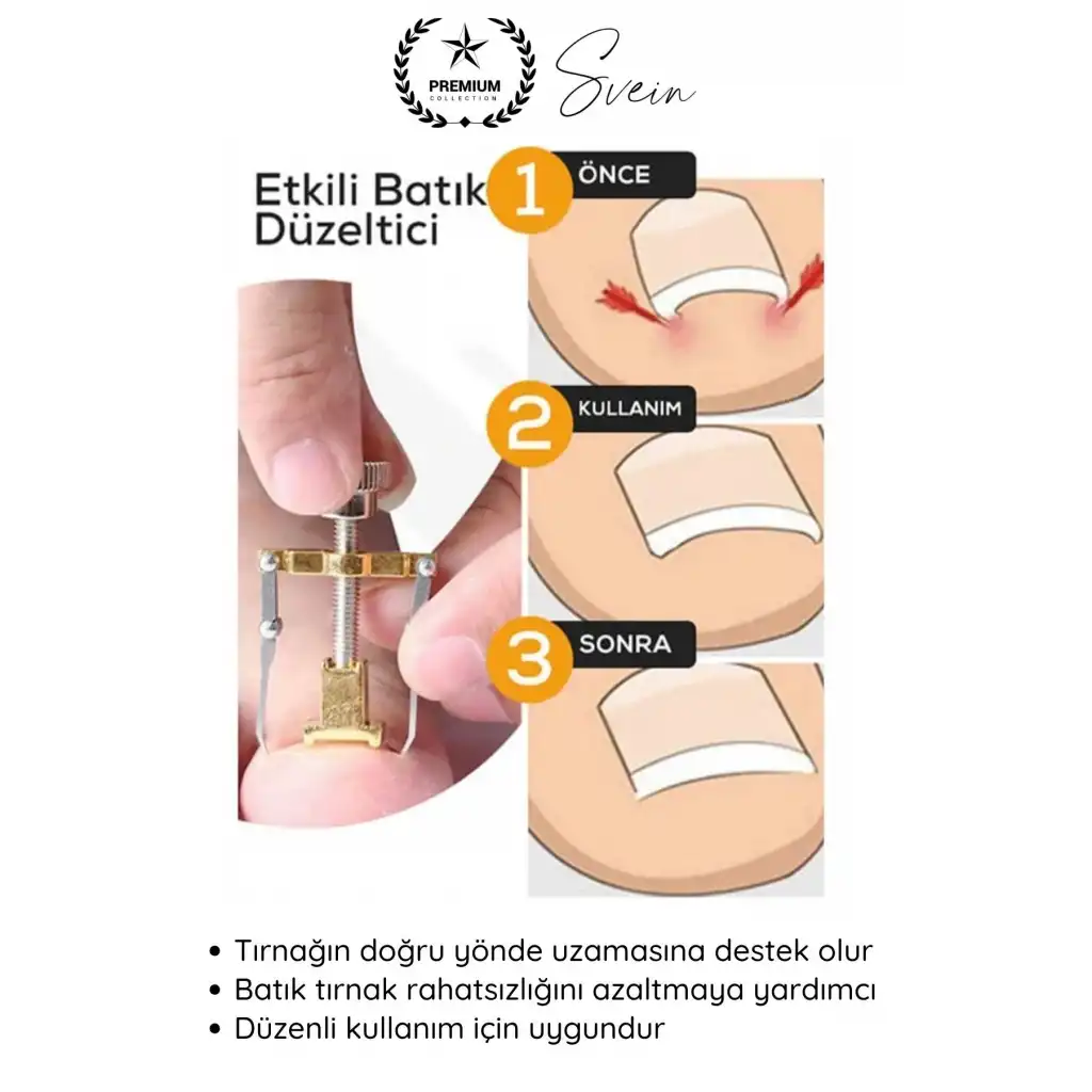 #Tırnak Ayak Tırnağı Batma Düzeltici Aparat Düzeltici Evde Kolay Pratik Batık Tırnak Bakım Aleti