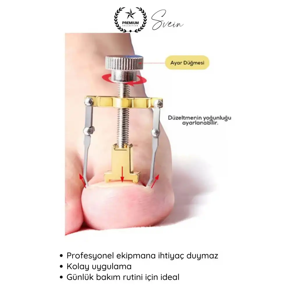 #Tırnak Ayak Tırnağı Batma Düzeltici Aparat Düzeltici Evde Kolay Pratik Batık Tırnak Bakım Aleti