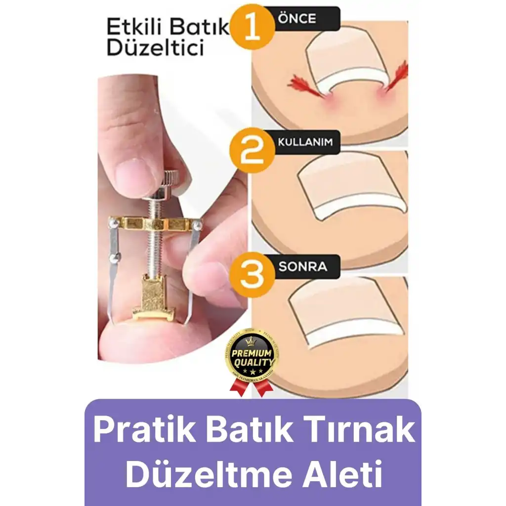 #Tırnak Kolay Bakım Orijinal Çelik Batma Ağrıyı Azaltan Düzeltme Aleti Batık Tırnak Çıkartıcı Aparat