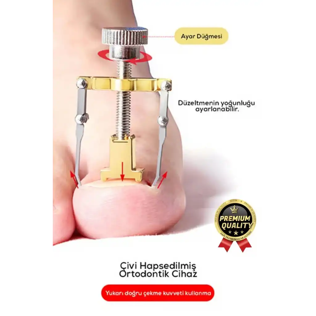 #Tırnak Kolay Bakım Orijinal Çelik Batma Ağrıyı Azaltan Düzeltme Aleti Batık Tırnak Çıkartıcı Aparat