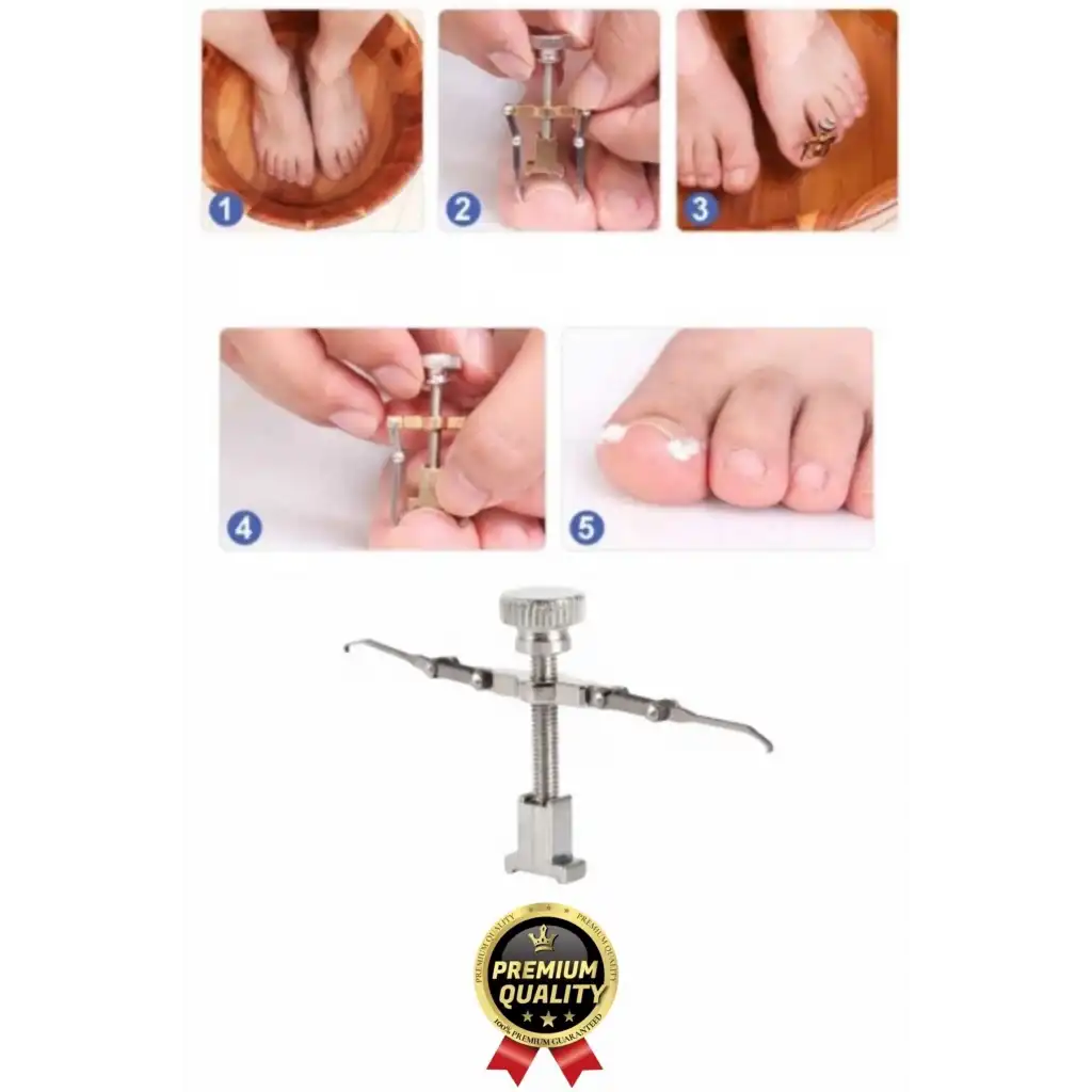 #Tırnak Kolay Bakım Orijinal Çelik Batma Ağrıyı Azaltan Düzeltme Aleti Batık Tırnak Çıkartıcı Aparat