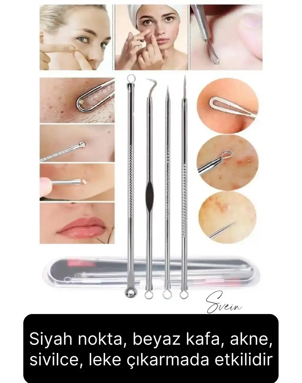 Siyah Nokta Akne Temizleyici Giderici Çıkarıcı Komedon 4lü Set Kutulu Yağ bezesi Sivilce İğnesi