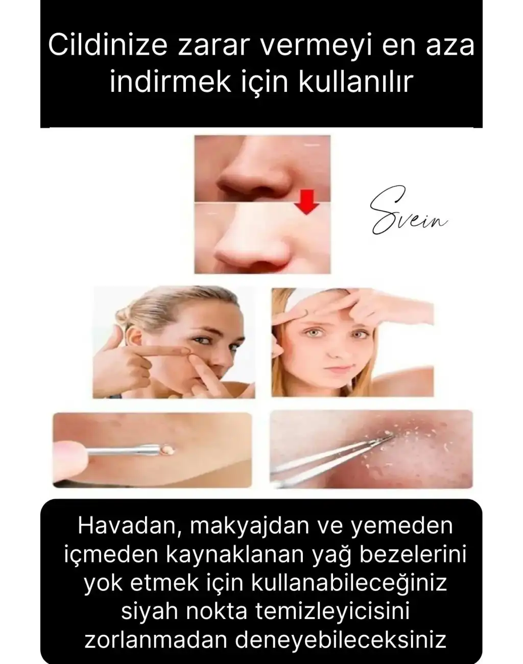 Siyah Nokta Akne Temizleyici Giderici Çıkarıcı Komedon 4lü Set Kutulu Yağ bezesi Sivilce İğnesi
