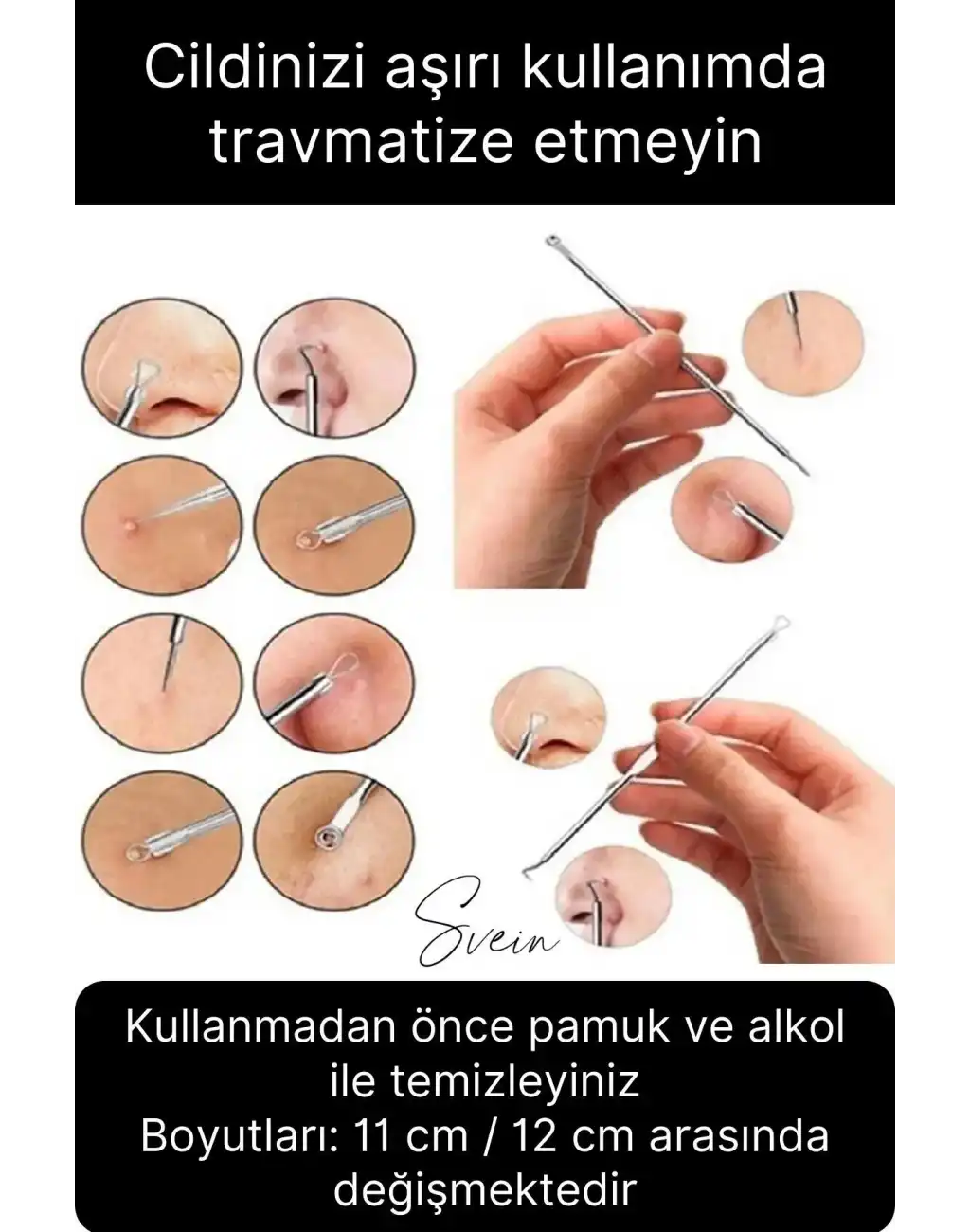 Siyah Nokta Akne Temizleyici Giderici Çıkarıcı Komedon 4lü Set Kutulu Yağ bezesi Sivilce İğnesi