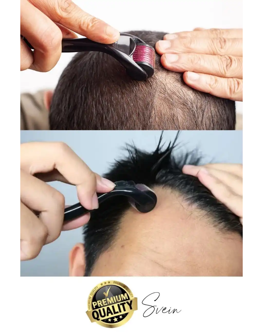 Profesyonel Cilt Bakımı Derma Roller Titanyum İğneli Saç Derisi Sakal Uzatma Büyütme Bıyık Çıkartma