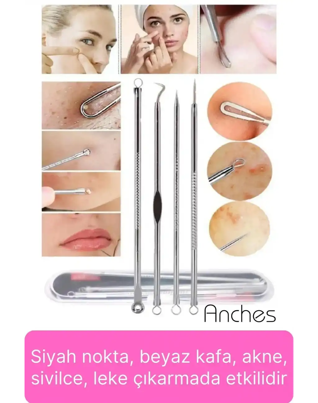 Siyah Nokta Akne Temizleyici Giderici Çıkarıcı Cilt Bakım 4lü Set Kutulu Yağ bezesi Sivilce İğnesi