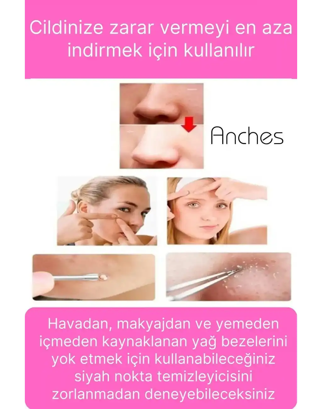 Siyah Nokta Akne Temizleyici Giderici Çıkarıcı Cilt Bakım 4lü Set Kutulu Yağ bezesi Sivilce İğnesi