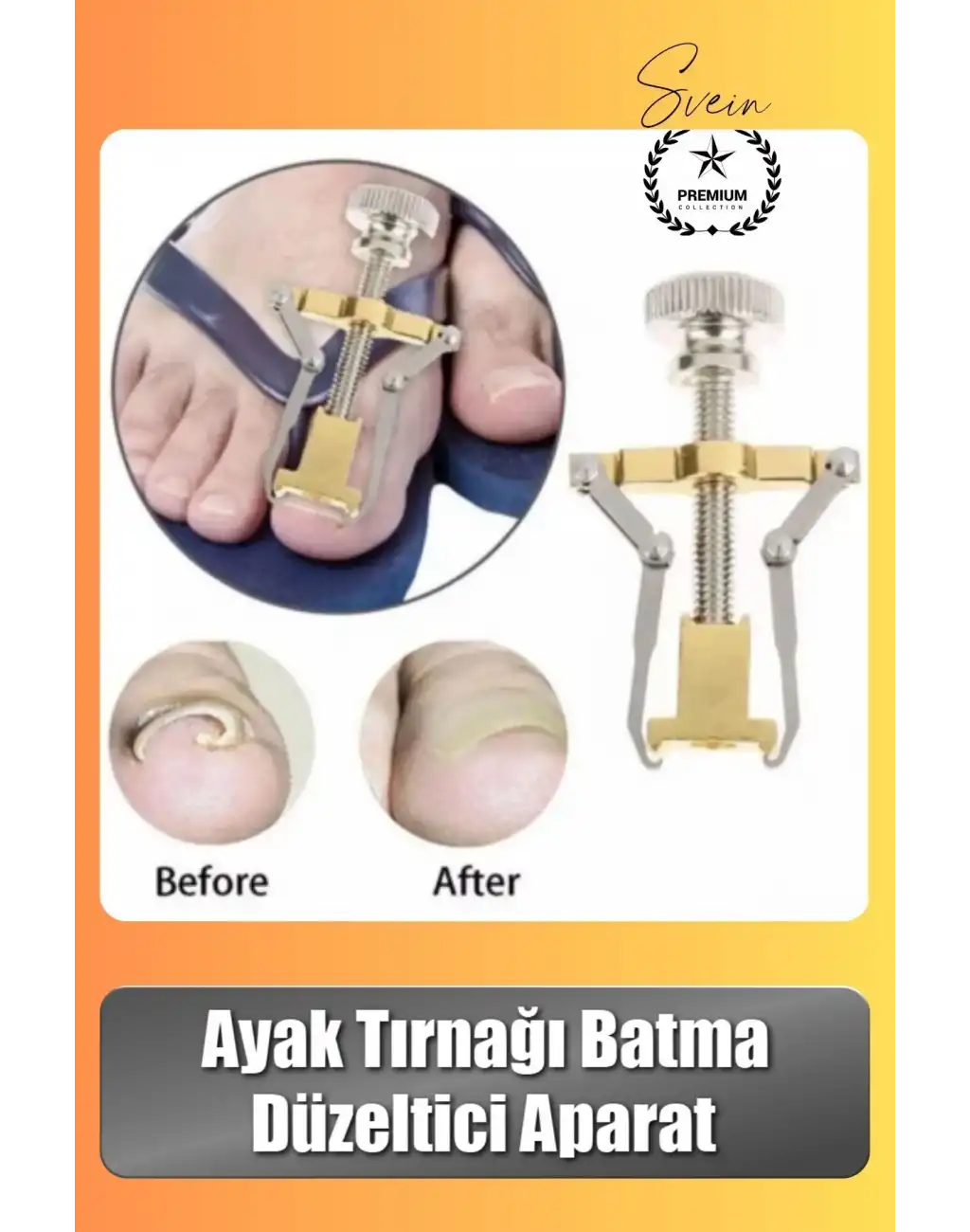 #Tırnak Ayak Tırnağı Batma Düzeltici Aparat Düzeltici Evde Kolay Pratik Batık Tırnak Bakım Aleti