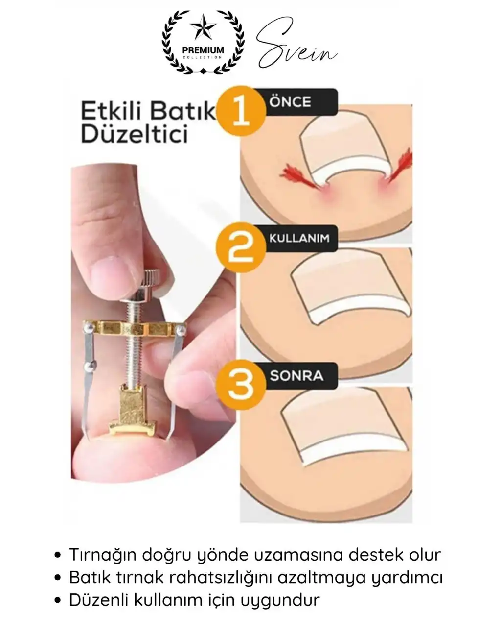 #Tırnak Ayak Tırnağı Batma Düzeltici Aparat Düzeltici Evde Kolay Pratik Batık Tırnak Bakım Aleti