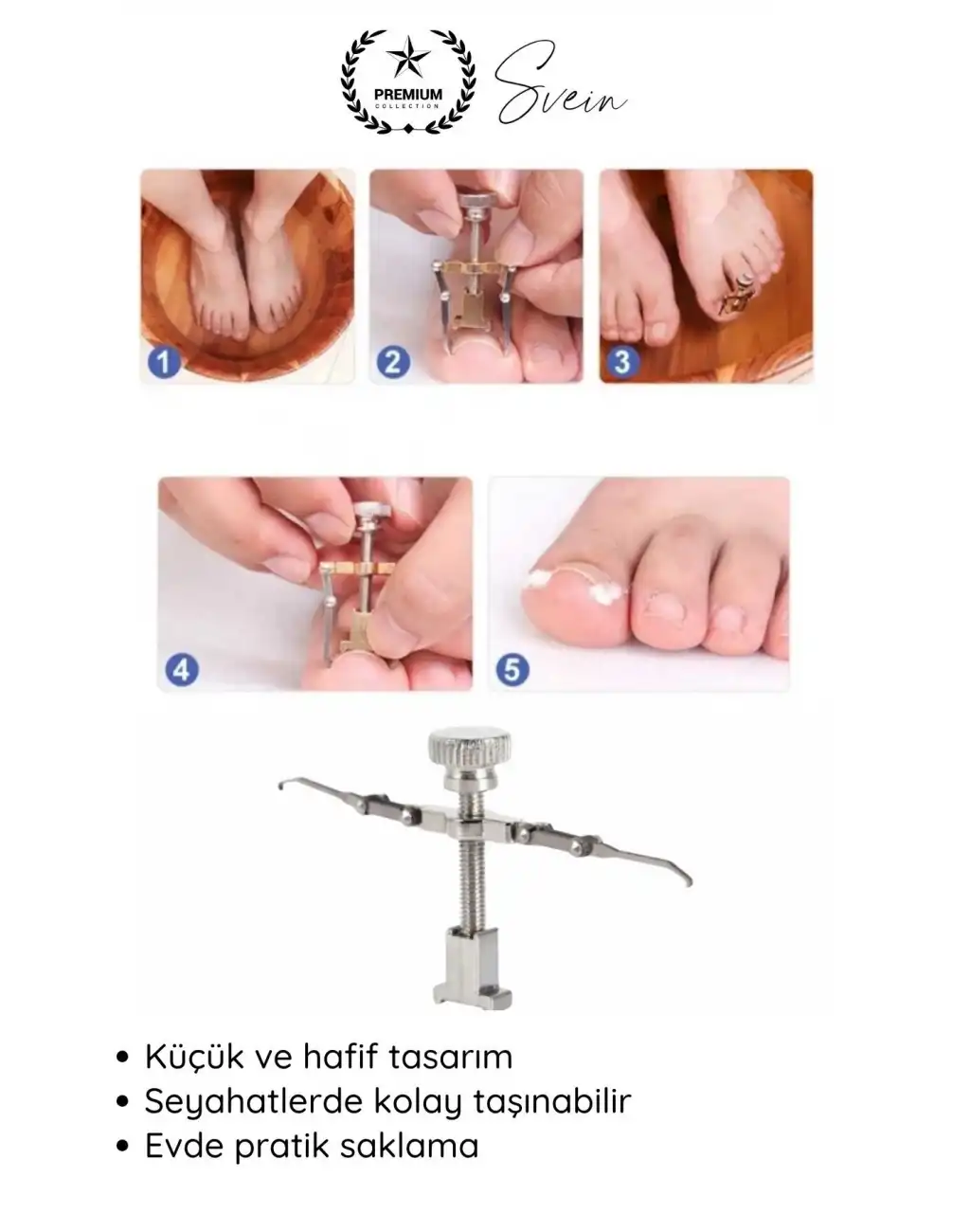 #Tırnak Ayak Tırnağı Batma Düzeltici Aparat Düzeltici Evde Kolay Pratik Batık Tırnak Bakım Aleti