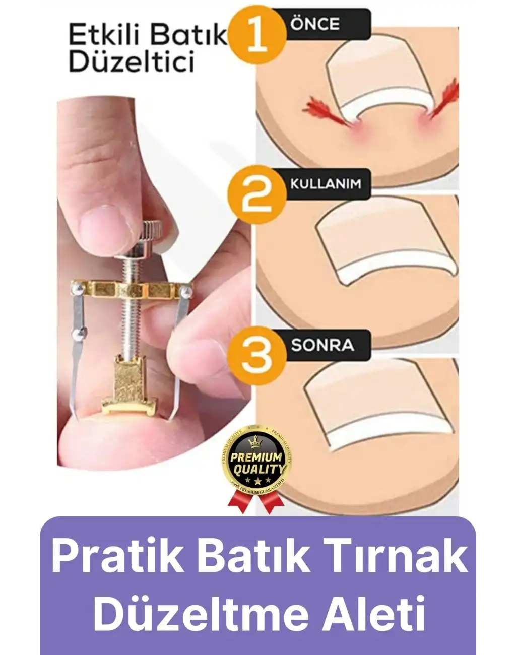 #Tırnak Kolay Bakım Orijinal Çelik Batma Ağrıyı Azaltan Düzeltme Aleti Batık Tırnak Çıkartıcı Aparat