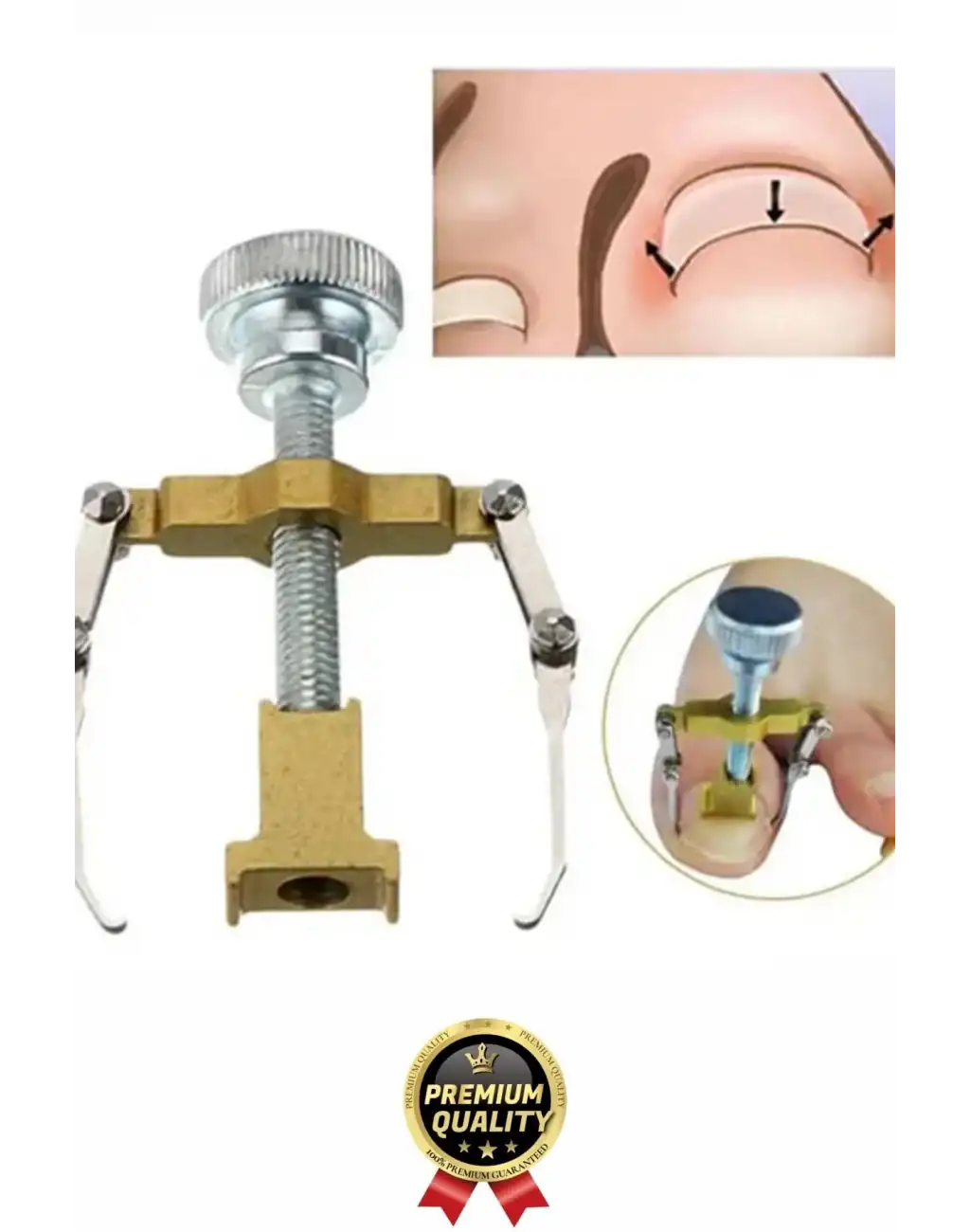 #Tırnak Kolay Bakım Orijinal Çelik Batma Ağrıyı Azaltan Düzeltme Aleti Batık Tırnak Çıkartıcı Aparat