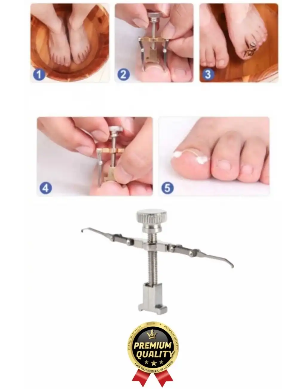 #Tırnak Kolay Bakım Orijinal Çelik Batma Ağrıyı Azaltan Düzeltme Aleti Batık Tırnak Çıkartıcı Aparat