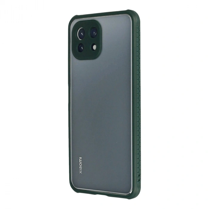 Mi 11 Lite Kılıf Miami Şeffaf  - Koyu Yeşil