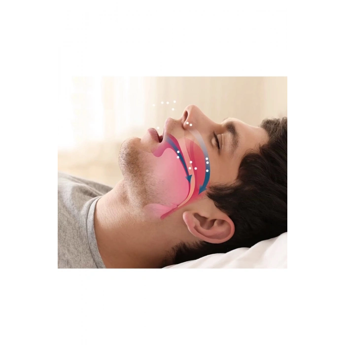 Rahat Uyku İçin Anti Snore Sleep Horlama Engelleyici Aparat Uyku Stoperi (  )