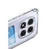 Note 14 Pro 5g Kılıf Kart Şeffaf  - Şeffaf