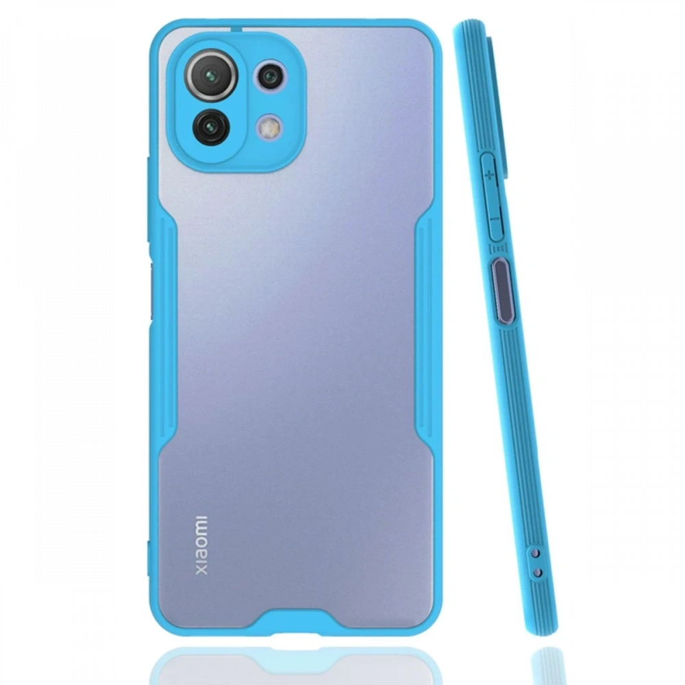 KILIFINI SEÇ - Xiaomi Mİ 11 Lite Kılıf Platin Silikon