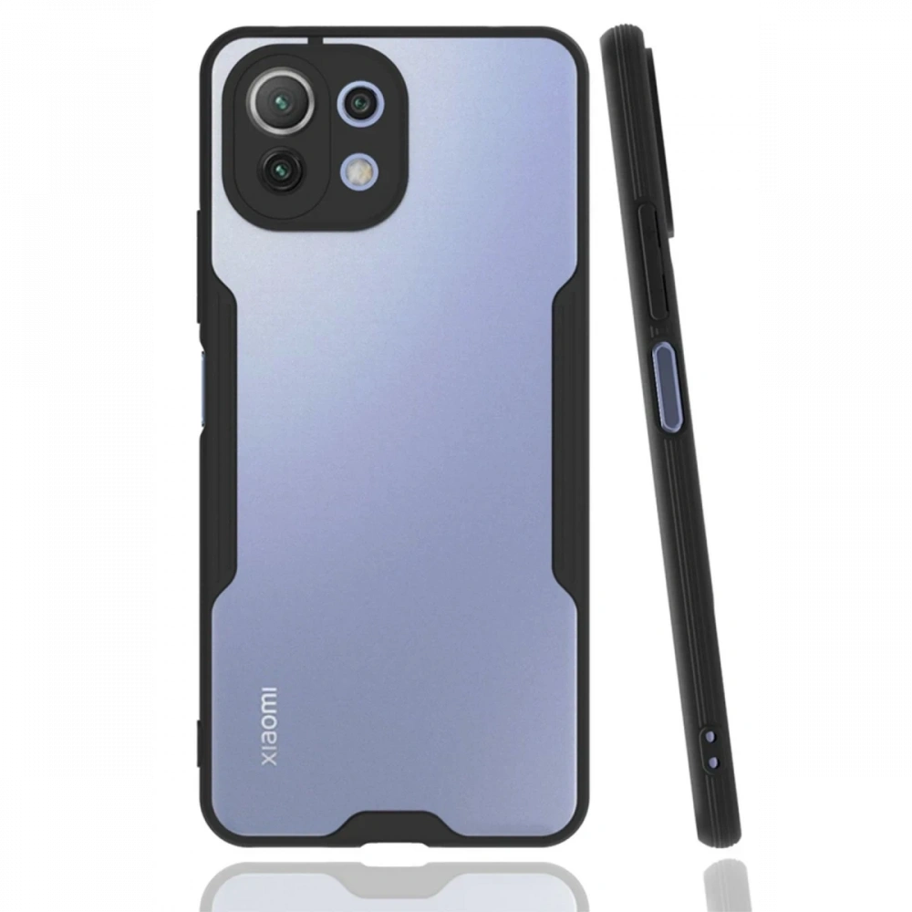 KILIFINI SEÇ - Xiaomi Mİ 11 Lite Kılıf Platin Silikon