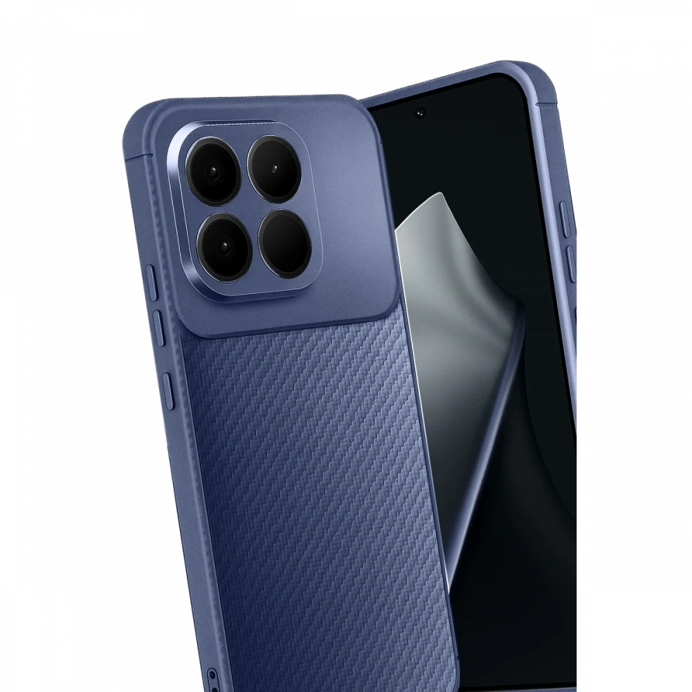 Newface Xiaomi Mi 15T Auto Focus Karbon Kapak