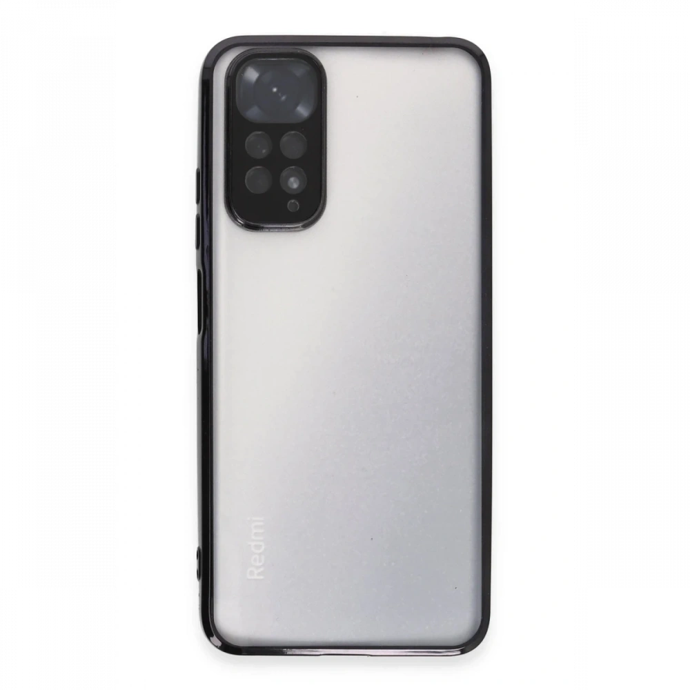 Newface Xiaomi Redmi Note 11 Kılıf Razer Lensli Silikon
