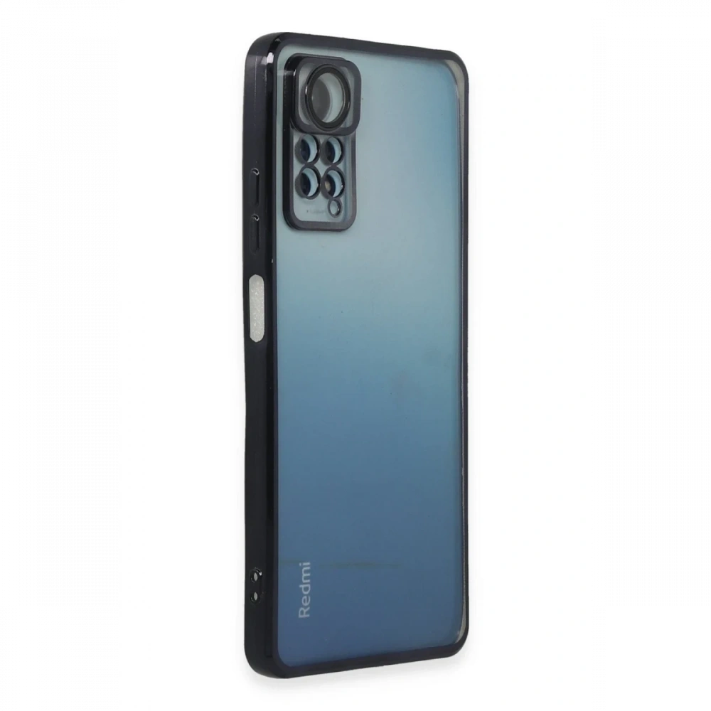 Newface Xiaomi Redmi Note 11 Pro Kılıf Razer Lensli Silikon