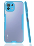 Newface Xiaomi Mİ 11 Lite Kılıf Platin Silikon - Mavi