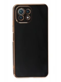 Newface Xiaomi Mİ 11 Lite Kılıf Volet Silikon - Siyah