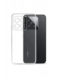 Newface Xiaomi Mi 15 Kılıf Lüx Şeffaf Silikon