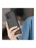 Newface Xiaomi Redmi Note 11 Kılıf Elegant Kapak - Pudra