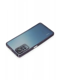 Newface Xiaomi Redmi Note 11 Pro Kılıf Razer Lensli Silikon - Mor