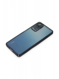 Newface Xiaomi Redmi Note 11 Pro Kılıf Razer Lensli Silikon - Siyah