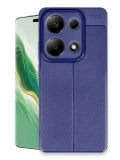 Newface Xiaomi Redmi Note 13 Pro 4G Kılıf Auto Focus Kapak - Lacivert