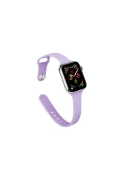 KILIFINI SEÇ - Apple Watch 38mm Klasik Kordon