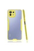 KILIFINI SEÇ - Xiaomi Mİ 11 Lite Kılıf Platin Silikon