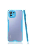 KILIFINI SEÇ - Xiaomi Mİ 11 Lite Kılıf Platin Silikon