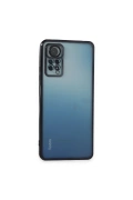 Newface Xiaomi Redmi Note 11 Pro Kılıf Razer Lensli Silikon